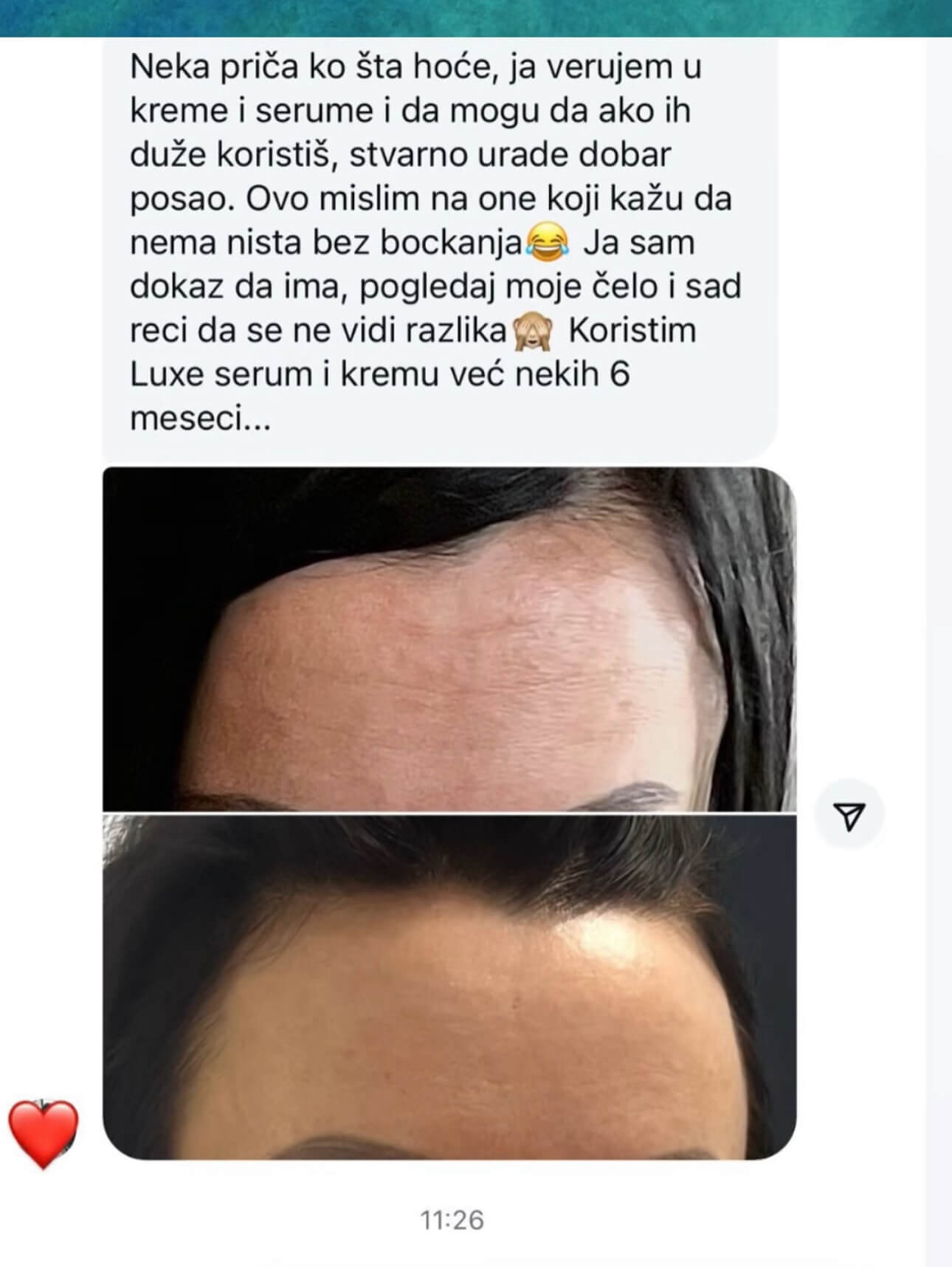 Lifting luxe oxygen - Slika 4