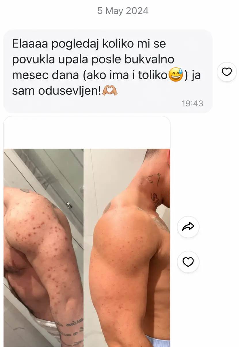 VIVA Body Rescue Set: SOS za kožu tela - Slika 13