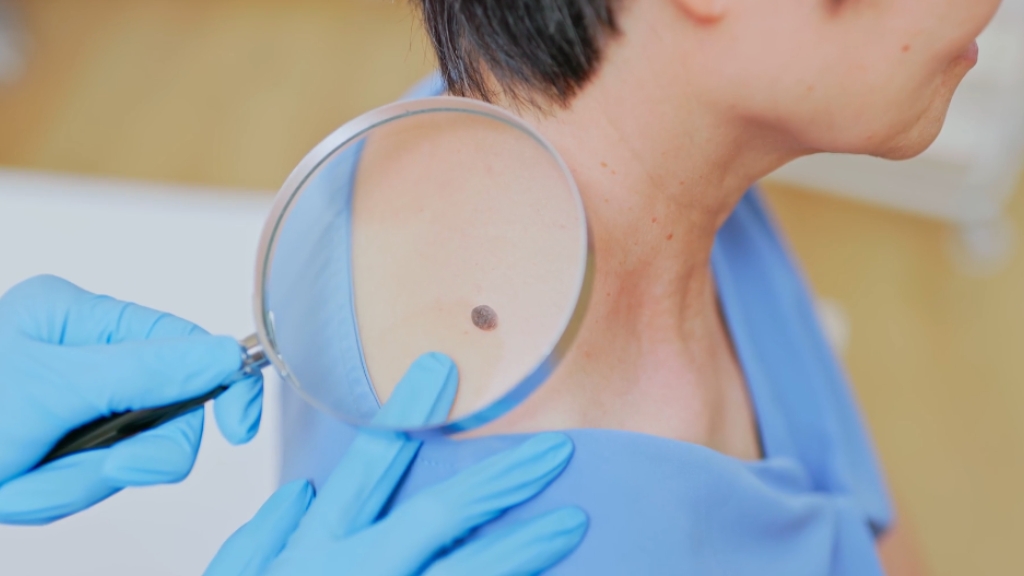 Dermatolog pregleda mladež pomoću lupe