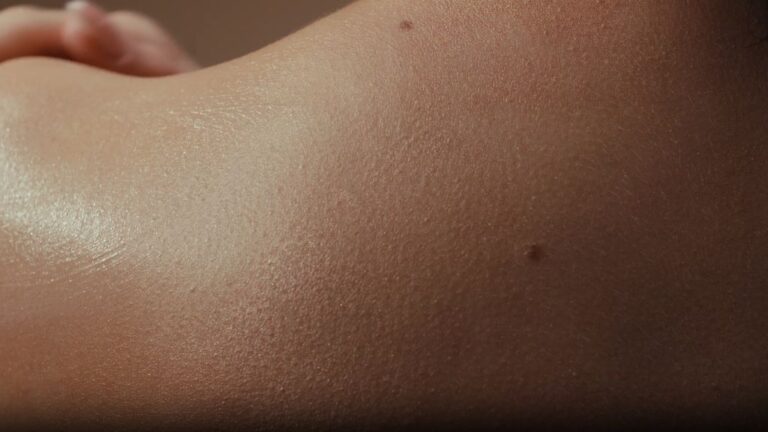 Kako razlikovati mladež od drugih promena na koži