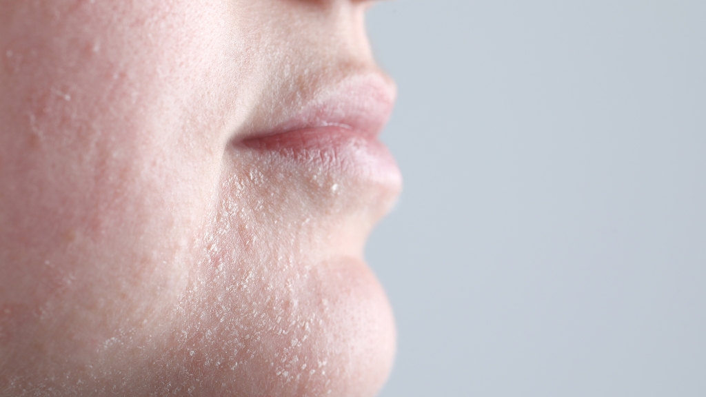 Perutanje kože brade iz profila