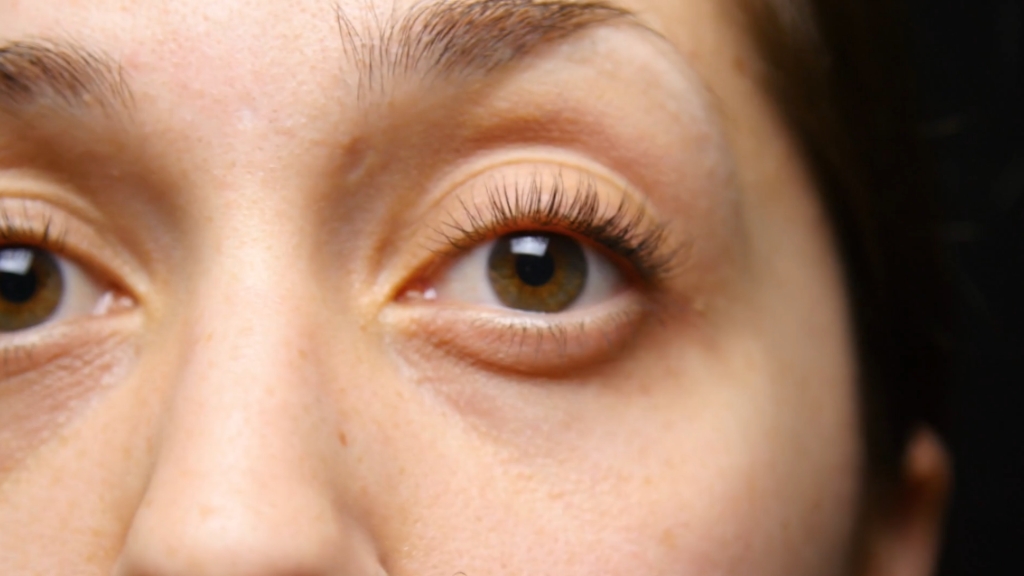 Žena sa tamnim podočnjacima izbliza