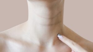 Kako sprečiti bore na vratu već u tridesetim?