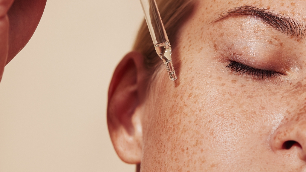 Žena nanosi serum pipetom na lice sa izraženim flekama i neujednačenim tenom