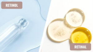 Retinol ili retinal? Šta izabrati za bore, akne i fleke