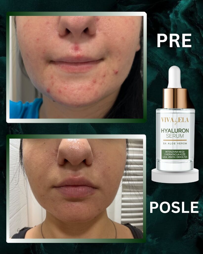 SnapReels.Net 471838286 17985446858779798 5984318590970821900 n