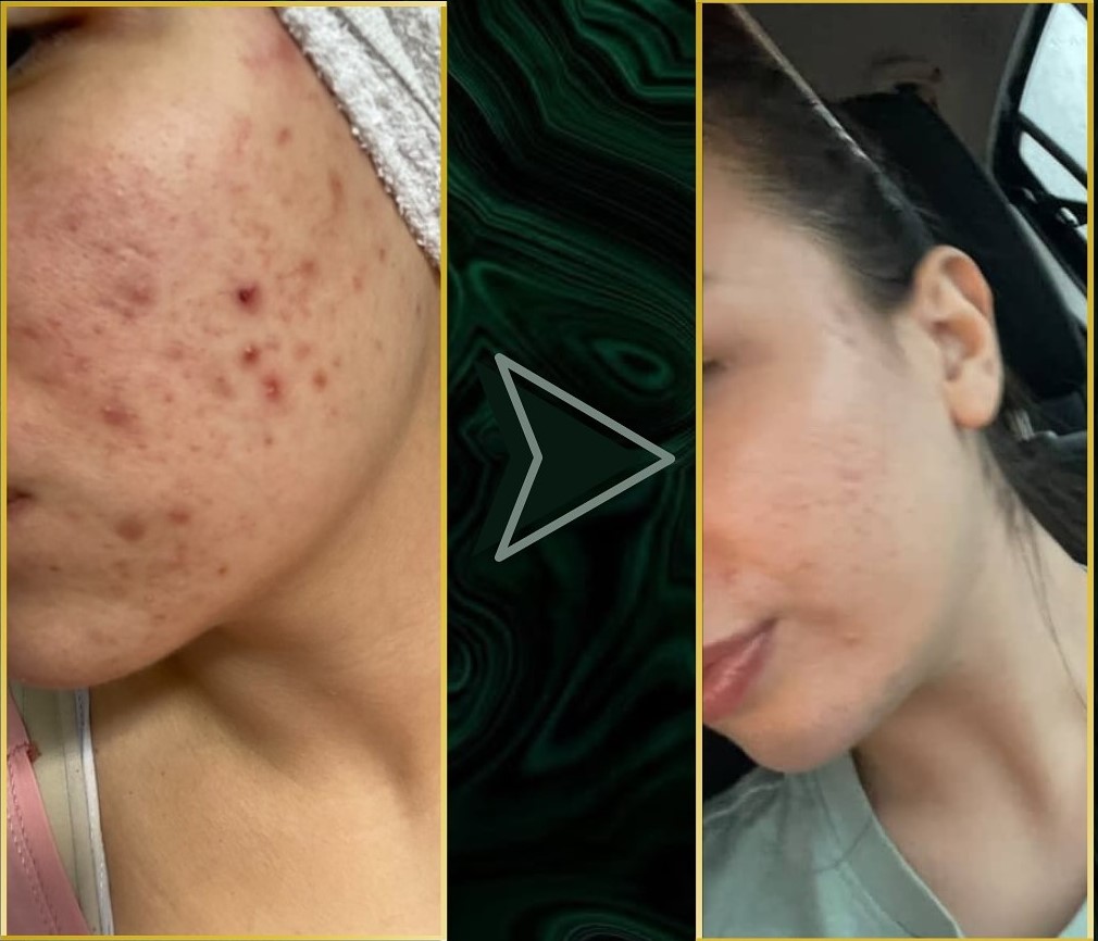 SnapReels.Net 495148949 18000318647779798 4061643705262993704 n