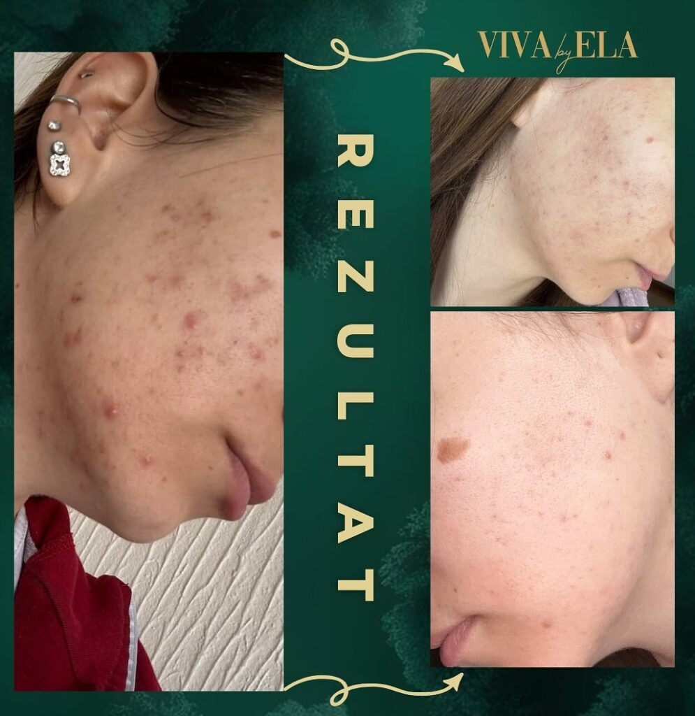 SnapReels.Net 499598801 18002282696779798 4974103826371569258 n