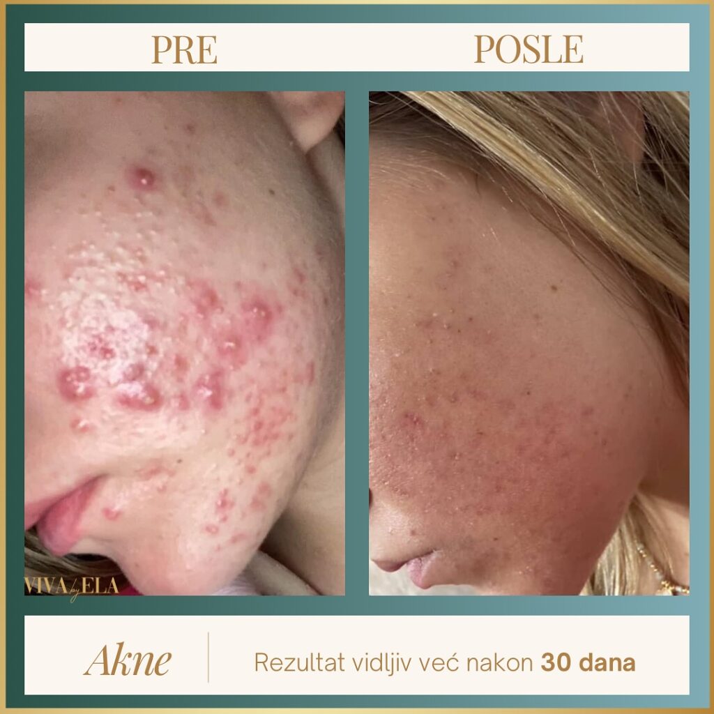 SnapReels.Net 551642595 18017120660779798 284145526654933503 n