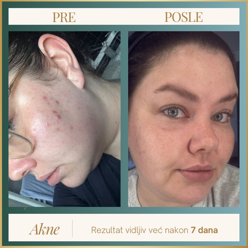 SnapReels.Net 558354614 18018824618779798 4563399720080479701 n